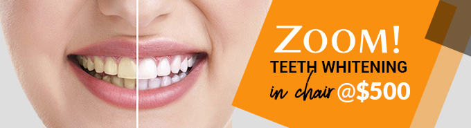 Zoom! Teeth Whitening