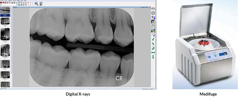 Degital X-rays