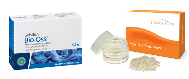 COW BONE GRAFTS